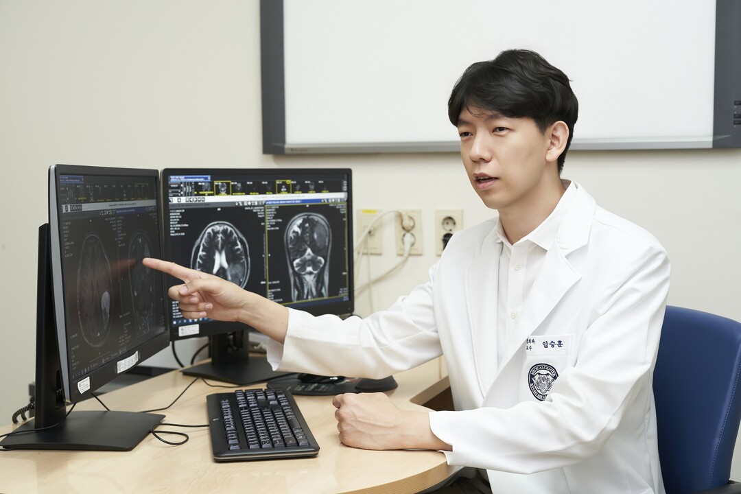 “같은 양성인데 누구는 안심, 누구는 위험?” 뇌종양, 위치와 크기가 위험도 가른다